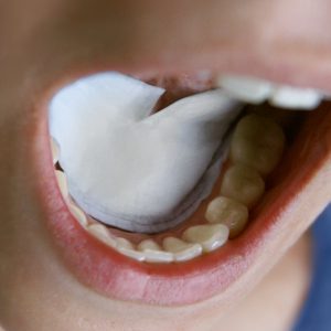 پد جذب کنترل رطوبت دهان دایرکتا سوئد drydent 2 زیر زبانی و بزاغی